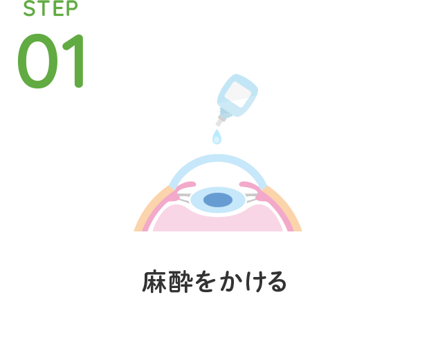 STEP01 麻酔をかける